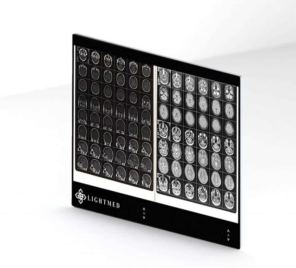 نگاتوسکوپ دوخانه