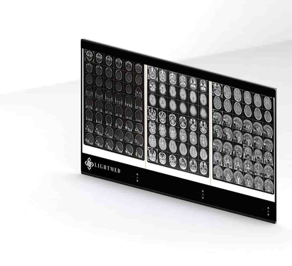 نگاتوسکوپ سه خانه