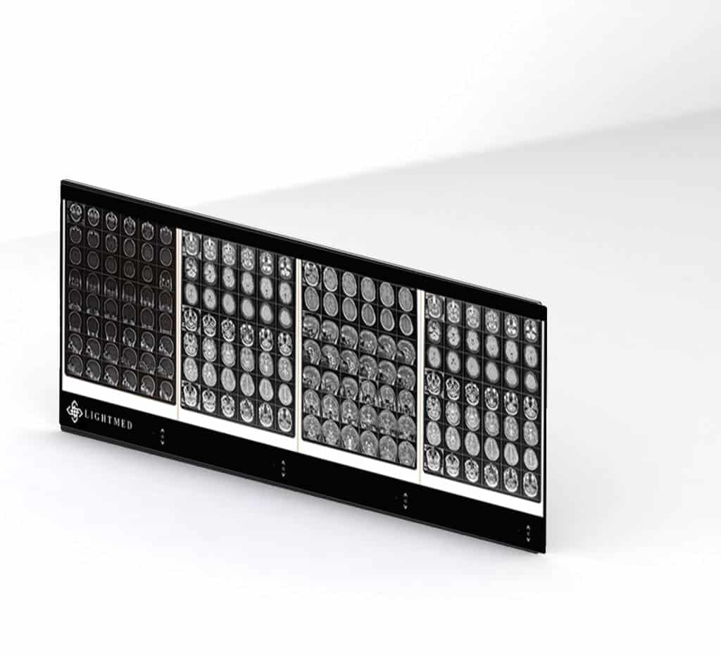 نگاتوسکوپ چهار خانه